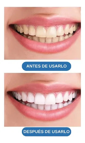 COMBO LAPIZ BLANQUEADOR DENTAL + LEUCONYCHIA PARA LOS HONGOS EN LAS UÑAS